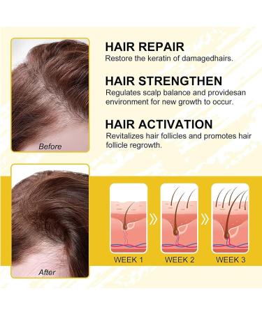 EXQST Suki-Bay Rice Water Advanced Serum Rice Water Hair Serum Hair Oil for Dry Damaged Hair and Growth - Buy Online on GoSupps.com