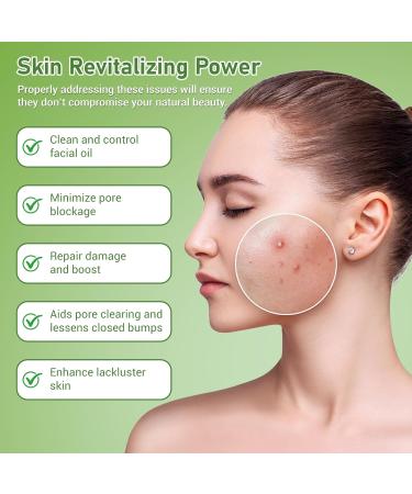 Eofot 14% Azelaic Acid Acne Cream Azelaic Acid For Face Helps Improve the Appearance of Acnes - Azalecic Acids Acido Azelaico 1 Fl Oz - Buy Online on GoSupps.com