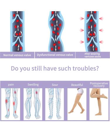 Evolyline Medical Compression Stockings - 20-30 mmHg Support for Men & Women | Class 2 Thigh Highs to Prevent Varicose Veins (Beige) - Buy Online on GoSupps.com