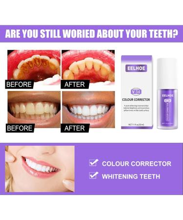 Buy 2 Pieces Tooth Cleaning Toothpaste - V34 Color Corrector & Sensitive Teeth Formula | International Shipping - Buy Online on GoSupps.com
