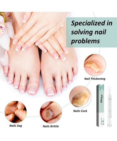 Nail Care Pen - Xixiran 4 PC Nail Repair for Fungus & Well-Groomed Nails | Intensive Nail Care Sticks - Buy Online on GoSupps.com