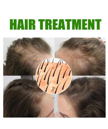 Organic Hair Growth Serum for Thinning Hair and Hair Loss - Nourishing Scalp Spray (120ml) - Buy Online on GoSupps.com