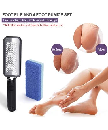 Professional Foot File Set - Portable Foot File with 4 Pack 2-in-1 Foot Pumices | Rust-Resistant Foot Scrubber for Rough Dead Skin Removal | Durable Foot Pedicure Kit for Callus & Wet/Dry Feet - Buy Online on GoSupps.com