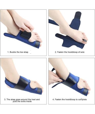 Hallux Valgus Corrector | Day & Night Foot Support for Bunion Relief | High Strength Correction - Buy Online on GoSupps.com