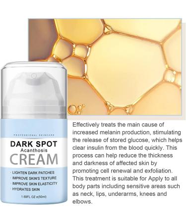 Fivfivgo Collagen Stimulating Acanthosis Nigricans Knee and Elbow Recovery Cream Dark Intensive Whitening Cream Body Cream Repair Black Spots - Buy Online on GoSupps.com
