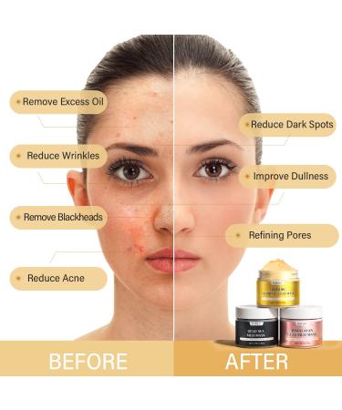 YLNALO Turmeric Vitamin C Clay Mask Set for Clear Skin - Deep Pore Cleansing, Blackhead & Acne Reduction, Oil Control, Brightening Formula - Dead Sea Mud & Himalayan Clay Masks - Buy Online on GoSupps.com