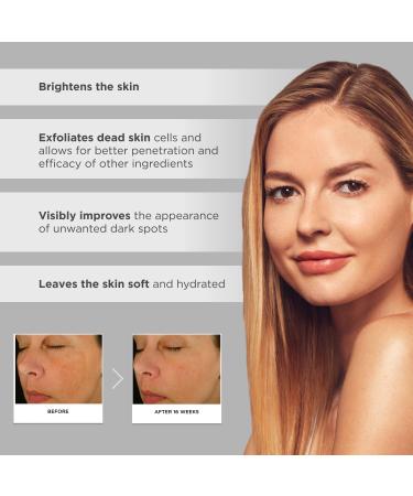 Glytone Enhance Brightening Complex 1 fl. oz. - 12% Azelaic Acid, 3% Glycolic Acid - Brightens Skin, Reduces Dark Spots - Non-Comedogenic - Buy Online on GoSupps.com