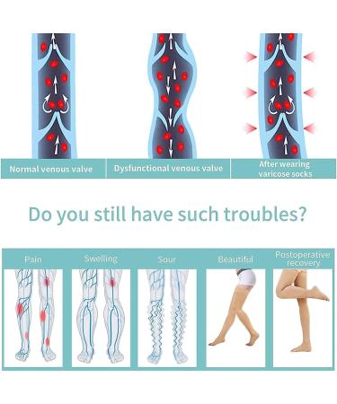 Thigh High 20-32 mmHg Compression Stockings - Toeless Socks for Men & Women - Silicone Dot Band - Beige Large (1 Pair) - Buy Online on GoSupps.com