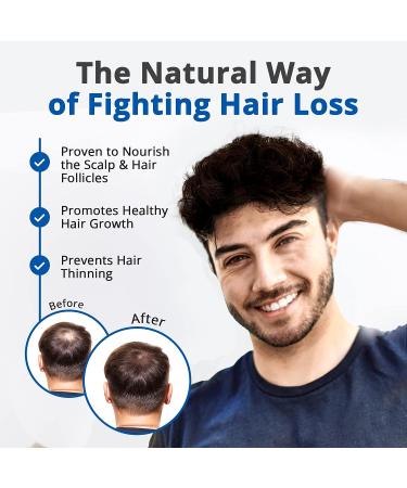 HAIRMETTO Saw Palmetto Hair Serum | Promotes Hair Regrowth, Soothes Scalp | Non-Oily, Peppermint Scent -118 mL - Buy Online on GoSupps.com