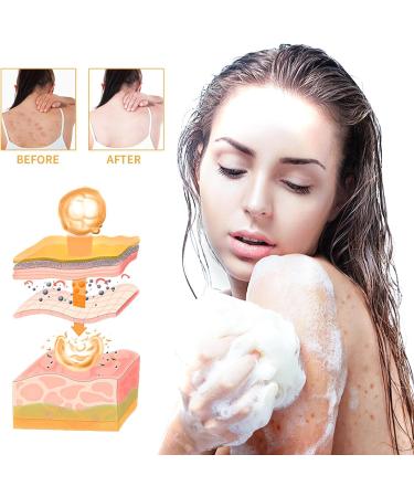 Turmeric Cleaning Soap - Dark Spot Corrector Remover - Natural Soap Bar for Body & Face - Skincare Handmade Soap Bar for Brighten Acne Dark Spots Hyperpigmentation Smooth Skin - Buy Online on GoSupps.com