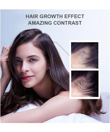 Ginger hair growth oil 30 ml ginger hair growth essential oil ginger hair treatment oil hair growth solution essential oil against hair loss shampoos - Buy Online on GoSupps.com