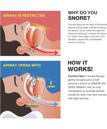 ANCALM Anti Snoring Device - Universal Fit | Stop Snoring Now - Buy Online on GoSupps.com