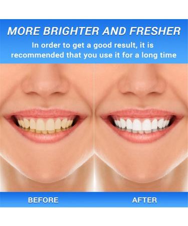 Body Accel Niacinamide Whitening Toothpaste - Stain Remover & Tooth-Up Formula (1PC) | Buy Internationally - Buy Online on GoSupps.com