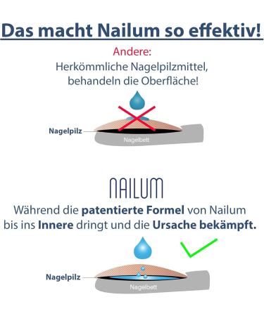 Nailum Anti-Nail Fungus Treatment - Effective Nail Polish 10ml for Strong Nail Fungus Relief - Buy Online on GoSupps.com