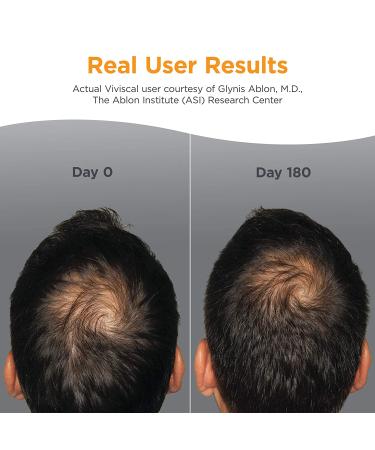 Viviscal Men's Hair Growth Supplements | Clinically Proven, Proprietary Collagen Complex | 180 Tablets - 3 Month Supply - Buy Online on GoSupps.com