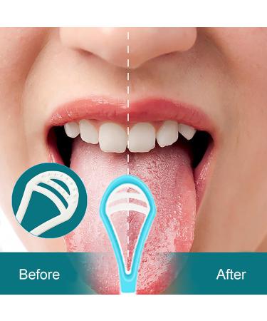 Premium Tongue Cleaner & Scraper - Effectively Freshen Breath & Clean Gently | 1 Piece - Buy Online on GoSupps.com