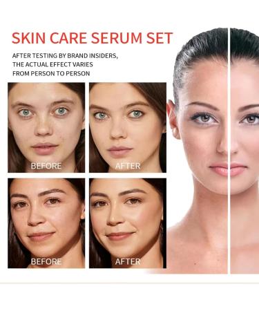  AmourGlint Face & Body Serum 300ml - Anti-aging and moisturizing treatment with Hyaluronic Acid and Vitamin C for radiant skin (300ml #4) - Buy Online on GoSupps.com