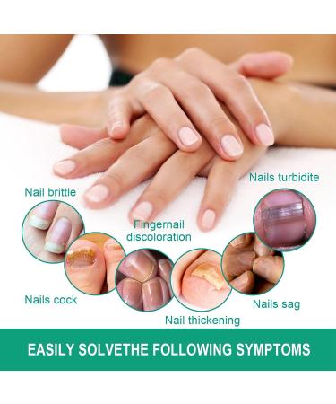 10ml Nail & Cuticle Oil Pen Natural Ingredients Nail Oil Pen Deeply Hydrating Moisturising Cuticle Oil for Nails Moisturizing Nail Oil with Soft Brush Nail Strengthener Clear Nail Polish Strengthening - Buy Online on GoSupps.com