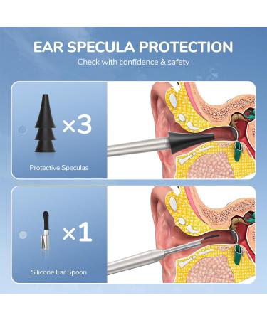 ScopeAround Otoscope with 2.8-Inch HD IPS Screen - 3.9mm HD Otoscope with Light for Clear Ear Inspections | International Shipping Available - Buy Online on GoSupps.com