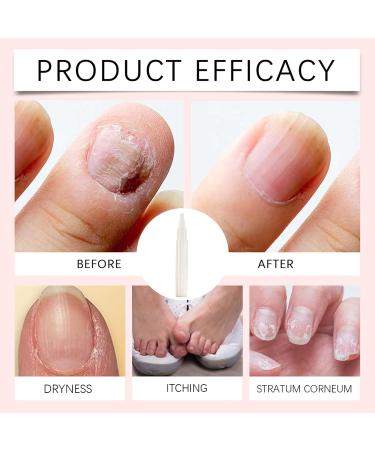 Stylo R parateur Pour Les Ongles | Soin Doux Nourrissant et Portable pour Ongles - Solution de Renouvellement pour Fortifier les - Pour Maman pouse Fille Petite Amie Filles Amoureux - Buy Online on GoSupps.com