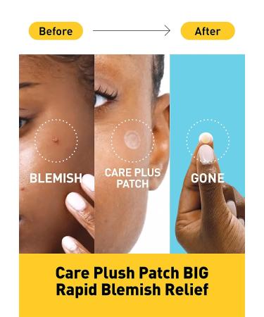 OLIVE YOUNG Care Plus Honey Scar Cover Pimple Patches 2 Pack - 168 Hydrocolloid Patch Spot Stickers with Manuka Honey for Acne and Blemishes - Buy Online on GoSupps.com