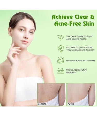 Antibacterial Tea Tree Soap Organic Tea Tree Oil Soap Antifungal Scrub Soap Bar Natural Cleanser Acne Athletes Foot Healthy Feet Skin Nails| Paraben and Cruelty Free 100g - Buy Online on GoSupps.com