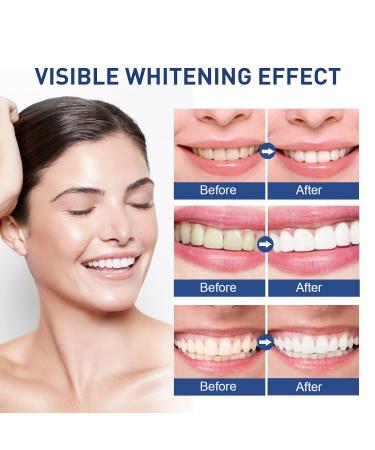 Teeth Whitening Paint 5ml - Oral Cleaning for Stains & Yellow Teeth - Whitens & Beautifies - One Size (White) - Buy Online on GoSupps.com