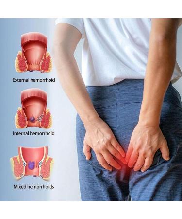 YUYAJK Hemorrhoids Cream Hemorrhoid Ointment Natural Herbs Fast Acting Ingredients Natural Hemorrhoid Ointment for Men and Women - Buy Online on GoSupps.com