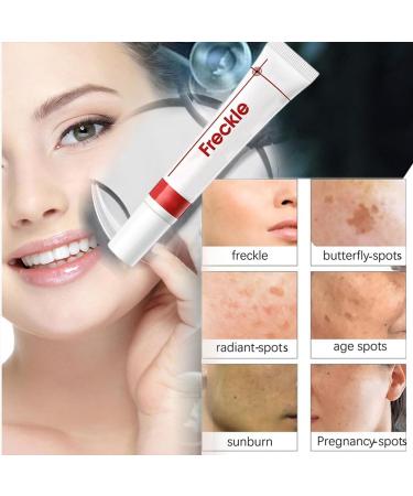 JIAOY 5 Pack Whitening Cream Anti Freckle Face Cream Spot Removal Moisturizer Lightening Face Concealer Anti Aging Cream - Buy Online on GoSupps.com