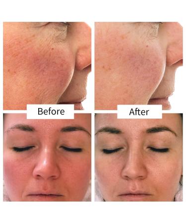 Buy LIFT LAB Lift Fix Calm Serum Reduce Redness & Inflammation 2 Fl Oz - International Shipping Available - Buy Online on GoSupps.com