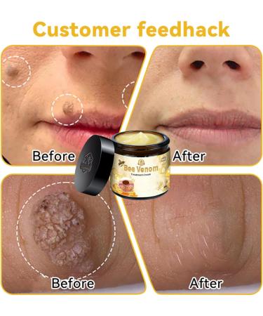ZVLZVL Bee Venom Skin Treatment Cream - Fast & Effective Repair for Men & Women | 1 Fl Oz - Professional Skin Care Solution - Buy Online on GoSupps.com
