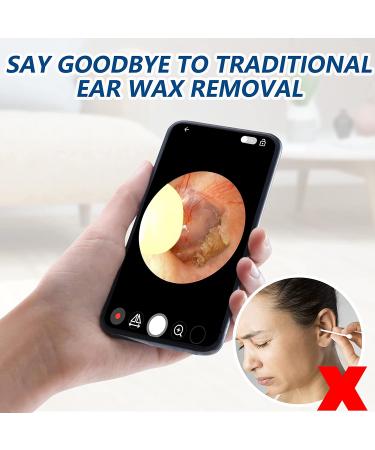 Wireless WiFi Ear Wax Removal Tool with 1296P FHD Camera - Smart Visual Earwax Remover for iPhone, iPad & Android - Buy Online on GoSupps.com