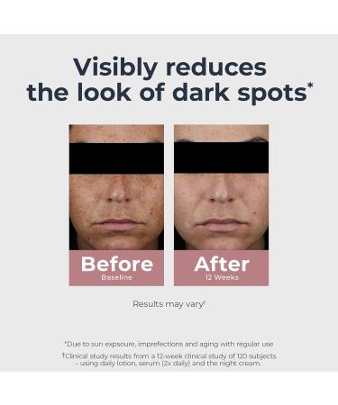 Eucerin Radiant Tone Dual Serum Dark Spot Corrector Dark Spot Serum with Thiamidol and Hyaluronic Acid Helps Visibly Reduce the Look of Persistent Dark Spots 1 Fl Oz Bottle - Buy Online on GoSupps.com