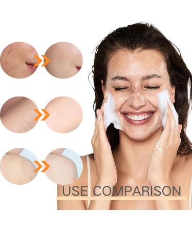 Turmeric Soap Turmeric Brightening Soap Turmeric Soap Bar For Face & Body Natural Soap For Moisturizing Shrinking Pores Cleaning Skin Acne Soap Ginger Extract Soap With Coconut Oil 100G - Buy Online on GoSupps.com