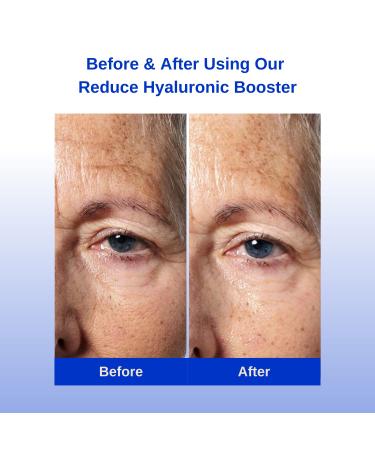 Michael Marcus Hyaluronic Booster PLUS - Anti-Aging Plant-Based Face Serum for Fine Lines & Wrinkles Intense Hydration & Radiance - 1oz Bottle - Buy Online on GoSupps.com