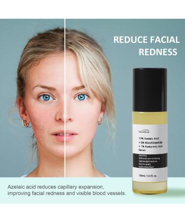 Azelaic Acid 10% Serum - Reduces Facial Redness | 3.4 fl. oz. (100ml) - Best Azelaic Acid Serum for Face | International Shipping Available - Buy Online on GoSupps.com