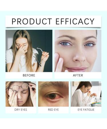 S rum pour les yeux Nano gouttes oculaires lubrifiantes oculaires r paratrices pour la r cup ration de la vision soulagement de la fatigue oculaire pour le soin des yeux (3 pi ce) - Buy Online on GoSupps.com