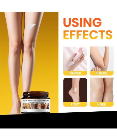 Dark Knuckle Remover Underarm Cream Body Moisturizer Lotion Toe Knuckles Removal Remover Corrector for Armpit Knees Elbow Inner Thigh Neck Private Part Intimate Skin Cream 4.21floz/120g - Buy Online on GoSupps.com