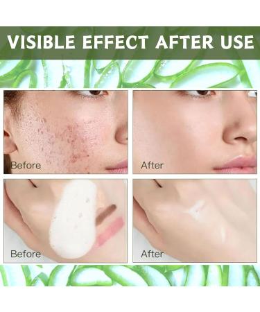Trendyfave Aloe Vera Gel Foaming Cleanser Face Wash Natural Acne Face Wash Built-In Silicone Cleaning Brush For Acne Prone & Oily Skin Exfoliating Face Wash - Soothe Purify Facial Skin Care - Buy Online on GoSupps.com