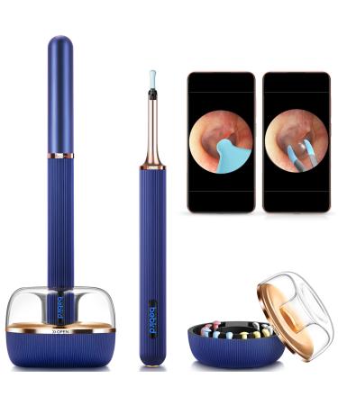BEBIRD® Note3 Pro Max,Ultimate Version,10 Megapixel HD Ear Wax Removal with Camera,Ear Wax Removal Tool with 25 Pieces,Tweezer and Rod All-in-1 Bebird Ear Cleaner,for iPhone,Android(Blue)