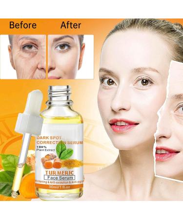 Turmeric Dark Spot Corrector Serum Turmeric Oil For Skin Wrinkles Facial Serum Natural Turmeric Face Serum for Skin Glow Dark Spot Corrector Serum Oil for Face & Body All Day Facial Moisturizer-30ml - Buy Online on GoSupps.com