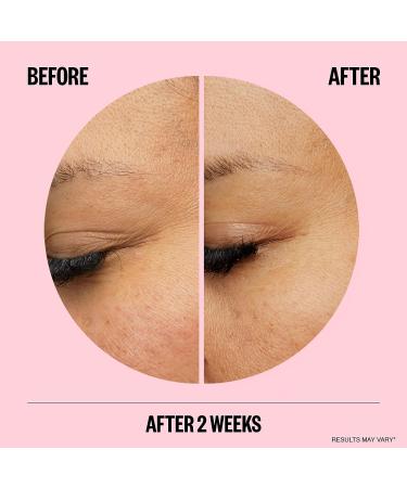 PEACE OUT Skincare Wrinkles: Hyaluronic Acid Microneedling Patches with Retinol, Peptides & Vitamin C - 6 Patches - Buy Online on GoSupps.com