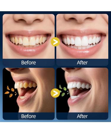 RAZOKO Mouthwash Travel Size-Portable Fresh Mint Packets,Alcohol & Fluoride Free Mouthwash,Disposable Oral Care Strips Mint 0.41 Fl Oz (Pack of 30) - Buy Online on GoSupps.com