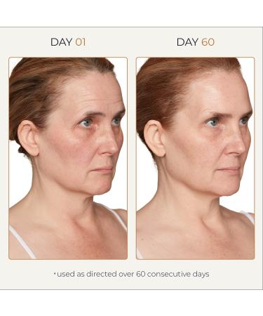 Tru Alchemy Spot Check Dark Spot Remover - Niacinamide, Hyaluronic Acid, Lactic & Glycolic Acid Serum - 1 fl oz/30 ml - Buy Online on GoSupps.com