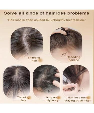 Ginger Plant Extract Anti-Hair Loss Hair Shampoo Ginger Plant Anti-Hair Loss Hair Shampoo Anti-Hair Loss And Hair Strengthening Shampoo Ginger Shampoo For Hair Growth - Buy Online on GoSupps.com