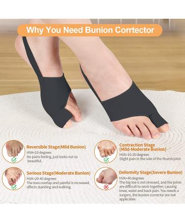 Bunion Corrector for Women and Men - Orthopedic Day/Night Support Splint for Bunions, Hallux Valgus & Crooked Toes (Black) - Buy Online on GoSupps.com