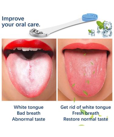 Tongue Scraper for Adults & Kids - Professional Tongue Cleaner for Bad Breath & White Tongue Treatment | Dentist Recommended - Silver-1pc - Buy Online on GoSupps.com