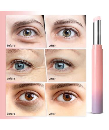 Shop Retinol Eye Cream for Dark Circles | Best Treatment for Puffiness & Eye Bags - for Men & Women - Buy Online on GoSupps.com