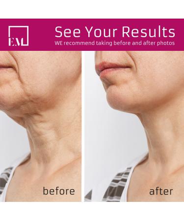 EpidermOpt Neck Firming Cream Anti-Aging Moisturizer for Face Neck and Chest 1.7 Oz Tightening and Lifting Formula - Buy Online on GoSupps.com