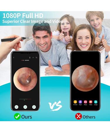 FOJOC Wireless Otoscope Ear Wax Remover Kit | 3.9mm Visual Camera | 1080P HD WiFi Endoscope | LED Light | Waterproof | for Adults, Kids, and Pets | Black - Buy Online on GoSupps.com